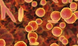 Mycoplasma hominis
